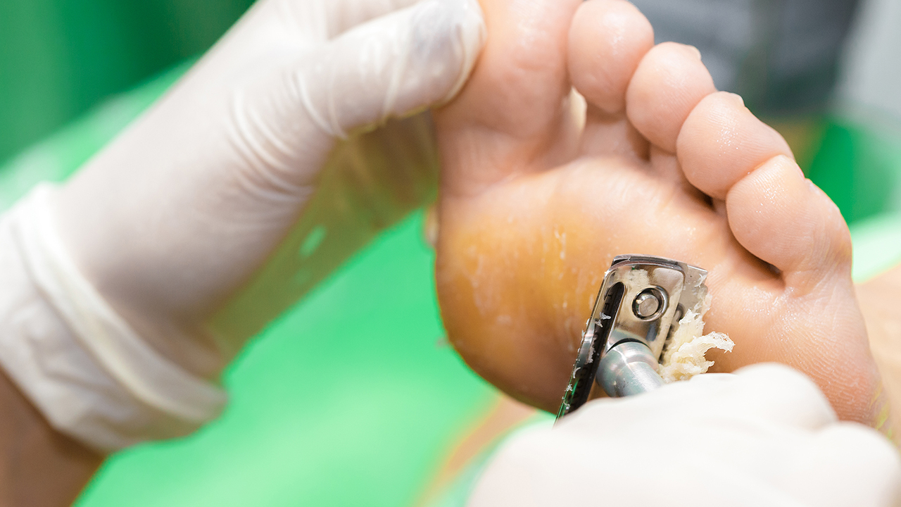 小孩子嚇到會雞眼嗎