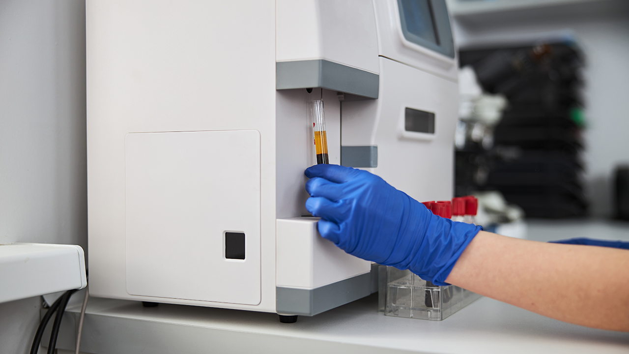 超聲能發現肝炎嗎？