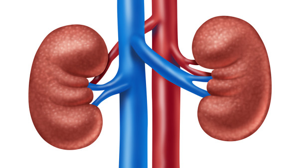多發性腎結石怎么辦