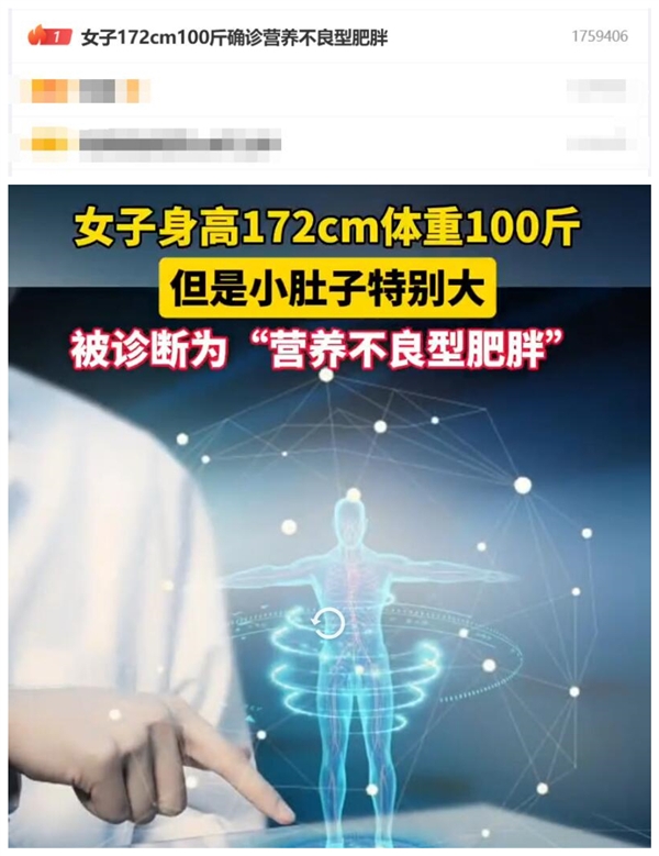 熱搜第一！女子172cm100斤確診營養不良型肥胖