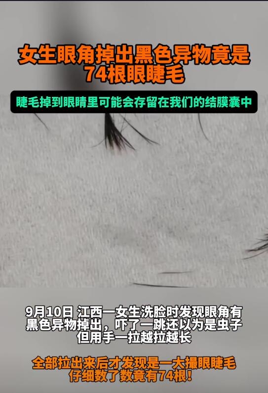 醫生回應女子眼角掉出74根眼睫毛：如有不適 建議檢查