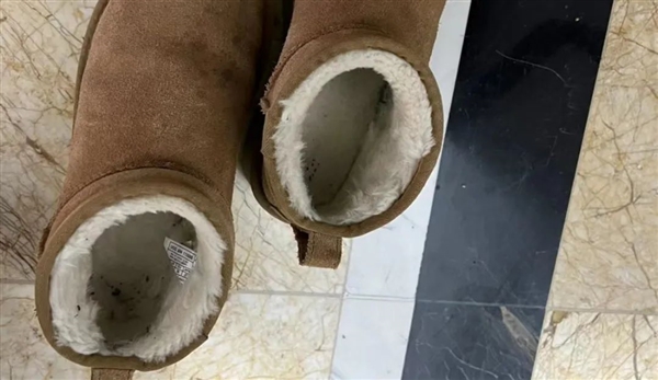 雪地靴又上熱搜！經常穿真的很傷腳 醫生緊急提醒